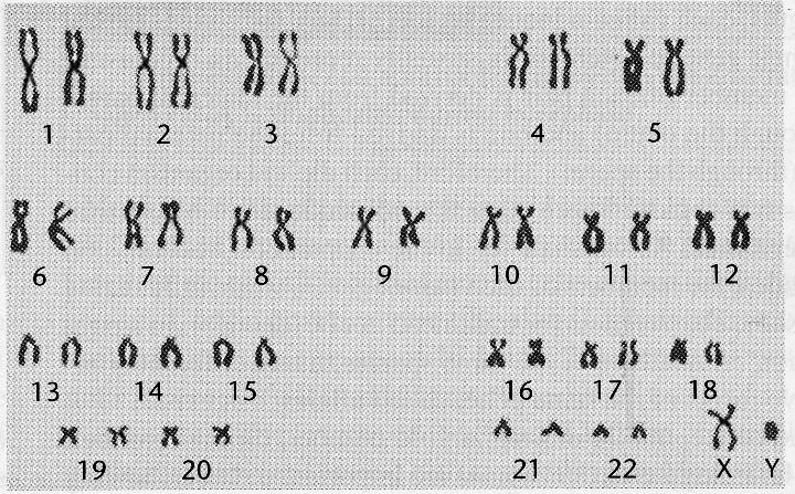Download the attached file. Activity 2 can be done as an electronic file in Word and follow the directions in the document. Please answer all questions in file form. No handwritten answers please. 1