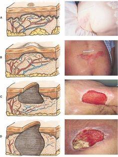 In this assignment, students will pull together the capstone project change proposal components they have been working on throughout the course to create a proposal inclusive of sections for each cont 2