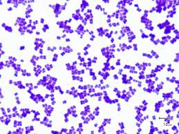 i have attached file 5