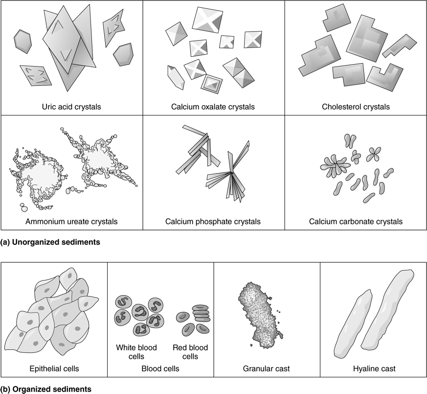 To successfully complete this assignment, first read the following exercise from the Laboratory Manual: Exercise 41A Urinalysis. Reference: Martini, F., &Nath, J. (2009). Fundamentals of anatomy & 1