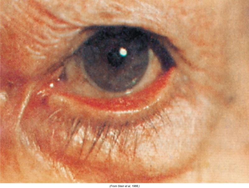 1.Compare landmarks of the neck on a male versus those on a female. Which is the largest endocrine gland in the body, and what two hormones does it produce?  In older adults, why does the thyroid gla 2